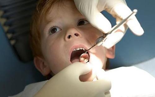 暑期带孩子矫正牙齿 为什么有时需要拔牙？
