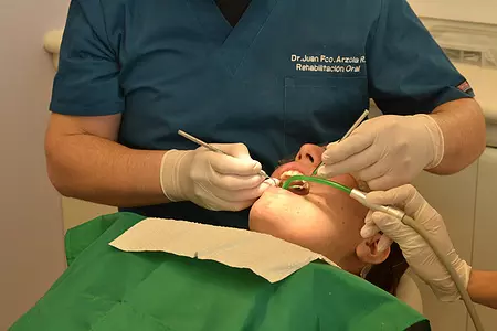 牙科医生在补牙高清图片